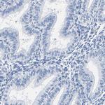 Prostein Antibody in Immunohistochemistry (IHC)