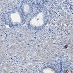 Prostein Antibody in Immunohistochemistry (IHC)