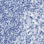 Prostein Antibody in Immunohistochemistry (IHC)