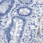 Prostein Antibody in Immunohistochemistry (IHC)