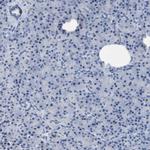 CRYM Antibody in Immunohistochemistry (Paraffin) (IHC (P))