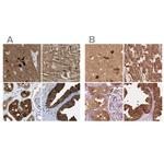 CRYM Antibody in Immunohistochemistry (IHC)