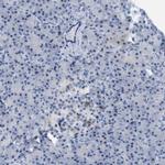 CRYM Antibody in Immunohistochemistry (IHC)