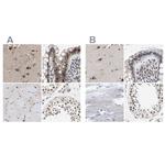 Nuclear Matrix Protein p84 Antibody in Immunohistochemistry (IHC)