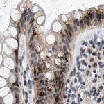 Nuclear Matrix Protein p84 Antibody in Immunohistochemistry (IHC)