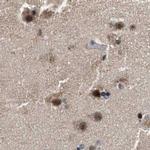 Nuclear Matrix Protein p84 Antibody in Immunohistochemistry (IHC)