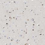 QKI Antibody in Immunohistochemistry (IHC)