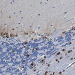 QKI Antibody in Immunohistochemistry (IHC)