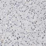 SMARCB1 Antibody in Immunohistochemistry (Paraffin) (IHC (P))