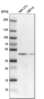 SMARCB1 Antibody in Western Blot (WB)