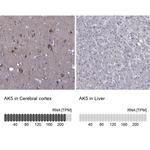 Adenylate Kinase 5 Antibody in Immunohistochemistry (IHC)