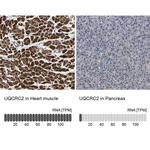 UQCRC2 Antibody in Immunohistochemistry (IHC)