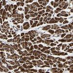 UQCRC2 Antibody in Immunohistochemistry (IHC)