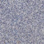 UQCRC2 Antibody in Immunohistochemistry (IHC)