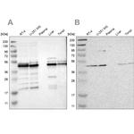 UQCRC2 Antibody in Western Blot (WB)