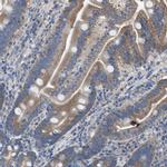 DOLPP1 Antibody in Immunohistochemistry (Paraffin) (IHC (P))