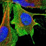 Aquaporin 1 Antibody in Immunocytochemistry (ICC/IF)