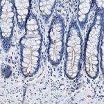 Aquaporin 1 Antibody in Immunohistochemistry (IHC)