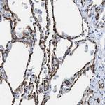 Aquaporin 1 Antibody in Immunohistochemistry (IHC)