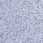 Aquaporin 1 Antibody in Immunohistochemistry (IHC)