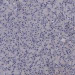 SLBP Antibody in Immunohistochemistry (Paraffin) (IHC (P))