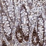 SLBP Antibody in Immunohistochemistry (Paraffin) (IHC (P))