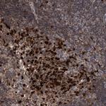 SLBP Antibody in Immunohistochemistry (Paraffin) (IHC (P))