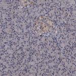 SLBP Antibody in Immunohistochemistry (IHC)