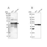 SLBP Antibody in Western Blot (WB)