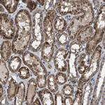 ARL6 Antibody in Immunohistochemistry (Paraffin) (IHC (P))