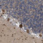 EOGT Antibody in Immunohistochemistry (Paraffin) (IHC (P))