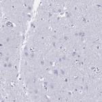 Defensin 6 Antibody in Immunohistochemistry (Paraffin) (IHC (P))