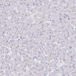 Defensin 6 Antibody in Immunohistochemistry (Paraffin) (IHC (P))