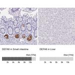 Defensin 6 Antibody in Immunohistochemistry (IHC)