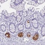 Defensin 6 Antibody in Immunohistochemistry (IHC)