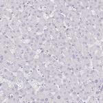 Defensin 6 Antibody in Immunohistochemistry (IHC)