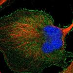 BAIAP2L1 Antibody in Immunocytochemistry (ICC/IF)