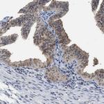 BAIAP2L1 Antibody in Immunohistochemistry (Paraffin) (IHC (P))