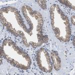 BAIAP2L1 Antibody in Immunohistochemistry (Paraffin) (IHC (P))