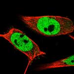 ING2 Antibody in Immunocytochemistry (ICC/IF)