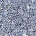 ING2 Antibody in Immunohistochemistry (IHC)