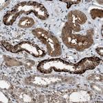 RFFL Antibody in Immunohistochemistry (Paraffin) (IHC (P))