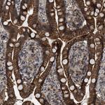 RFFL Antibody in Immunohistochemistry (Paraffin) (IHC (P))