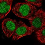 ELAC2 Antibody in Immunocytochemistry (ICC/IF)