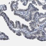 ELAC2 Antibody in Immunohistochemistry (Paraffin) (IHC (P))