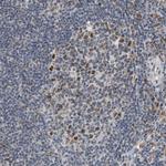 ELAC2 Antibody in Immunohistochemistry (Paraffin) (IHC (P))