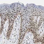 ELAC2 Antibody in Immunohistochemistry (Paraffin) (IHC (P))