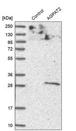 AGPAT2 Antibody in Western Blot (WB)