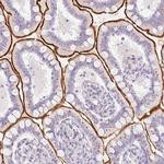 SLC28A1 Antibody in Immunohistochemistry (IHC)