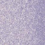 SLC28A1 Antibody in Immunohistochemistry (IHC)